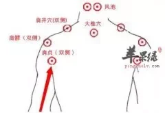 肩贞穴疼痛是怎么回事 教你缓解方法