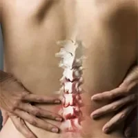 椎间盘突出的方式与治疗方法