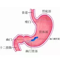 分餐进食能预防幽门螺杆菌感染