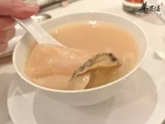 脊柱炎的症状及脊柱炎的食疗方法