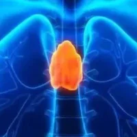 胸腺囊肿与胸腺瘤区别，胸腺囊肿做什么检查？