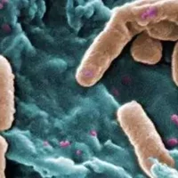 不动杆菌感染是怎么传染的？不动杆菌感染的症状