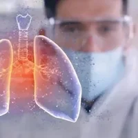 肺纤维化能治愈吗？肺纤维化的护理方法