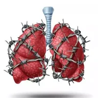 肺纤维化的原因是什么？肺纤维化晚期症状