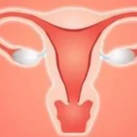 子宫内膜增生有哪些疾病分类？子宫内膜增生有哪些症状？