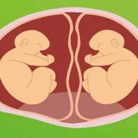 什么是异卵双胞胎？异卵双胞胎有哪些风险？