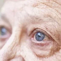 糖尿病患者的眼部为什么会发生病变？怎么预防糖尿病眼病？