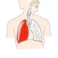 肺囊肿与肺大泡ct鉴别,如何鉴别肺囊肿与肺大泡