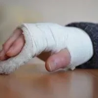 右手食指关节肿胀,关节肿胀的原因有哪些