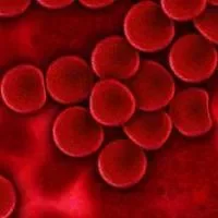 遗传性血红蛋白病的遗传几率大吗,遗传性血红蛋白病包括什么