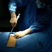 肾结石手术治疗大全,肾结石患者的术后注意事项
