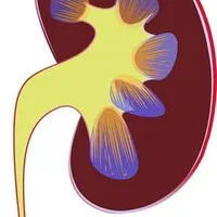 什么是多囊肾海绵肾,多囊肾和海绵肾的区别