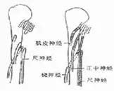 周围神经损伤恢复