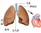 肺心病心功能不全