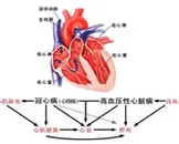 冠心病造影多少钱