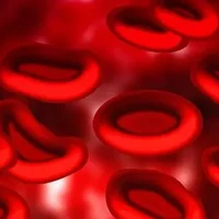 红细胞平均血红蛋白含量偏低的原因,血红蛋白含量偏低怎么办