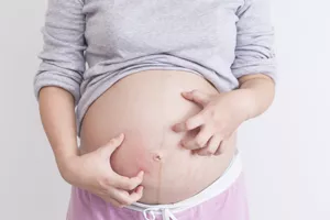 什么是孕晚期产检