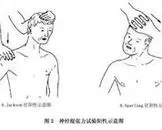 神经根型颈椎病的护理方法_神经根型颈椎病是怎么引起的