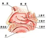 上颌鼻窦炎