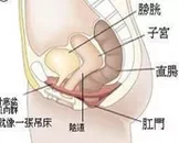 膀胱脱垂的病因是什么