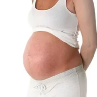 重度宫颈炎怀孕生子,重度宫颈炎怀孕几率大吗