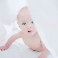 婴儿为什么出现眼睑水肿,胎儿水肿是为什么_