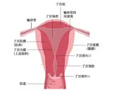 [直肠子宫内膜异位症cea]协和张羽的诊间日记：又查获一个子宫内膜异位症