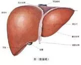 慢性重型肝炎