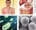 无菌性与细菌性前列腺炎的鉴别