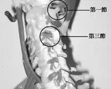 脊椎骨质增生的护理方法_脊椎骨质增生有哪些症状
