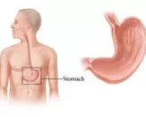 慢性胃炎伴肠上皮化生如何治疗