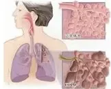 外伤肺气肿有哪些症状？