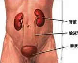 膀胱腺性膀胱炎的症状有哪些