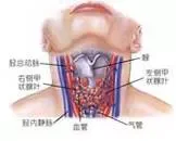 放射性甲状腺炎的病因是什么