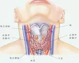 甲状腺亢进就是甲亢吗