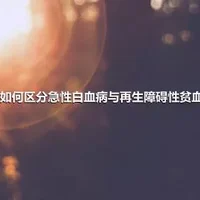 如何区分急性白血病与再生障碍性贫血