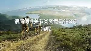 银屑病性关节炎究竟是什么疾病呢