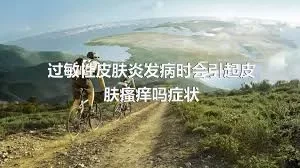 过敏性皮肤炎发病时会引起皮肤瘙痒吗症状