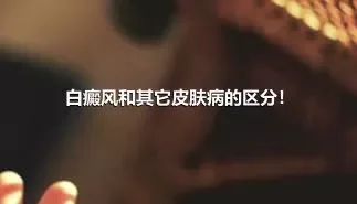 白癜风和其它皮肤病的区分！