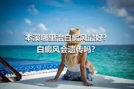 本溪哪里治白癜风最好？白癜风会遗传吗？