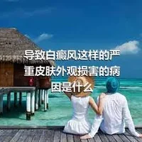 导致白癜风这样的严重皮肤外观损害的病因是什么