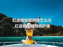 红皮病型银屑病怎么治,红皮病型银屑病护理