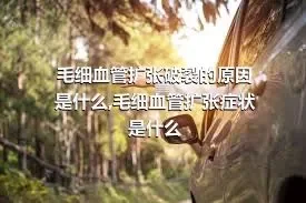 毛细血管扩张破裂的原因是什么,毛细血管扩张症状是什么