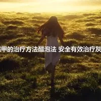 灰指甲的治疗方法醋泡法 安全有效治疗灰指甲