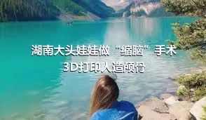 湖南大头娃娃做“缩脑”手术 3D打印人造颅骨