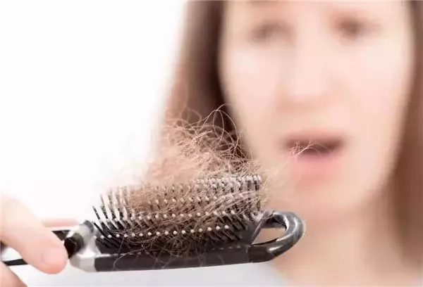 防脱发最好的方法是什么
